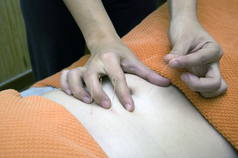 osteopathe-LA ROQUE EN PROVENCE-min_acupuncture-4175625